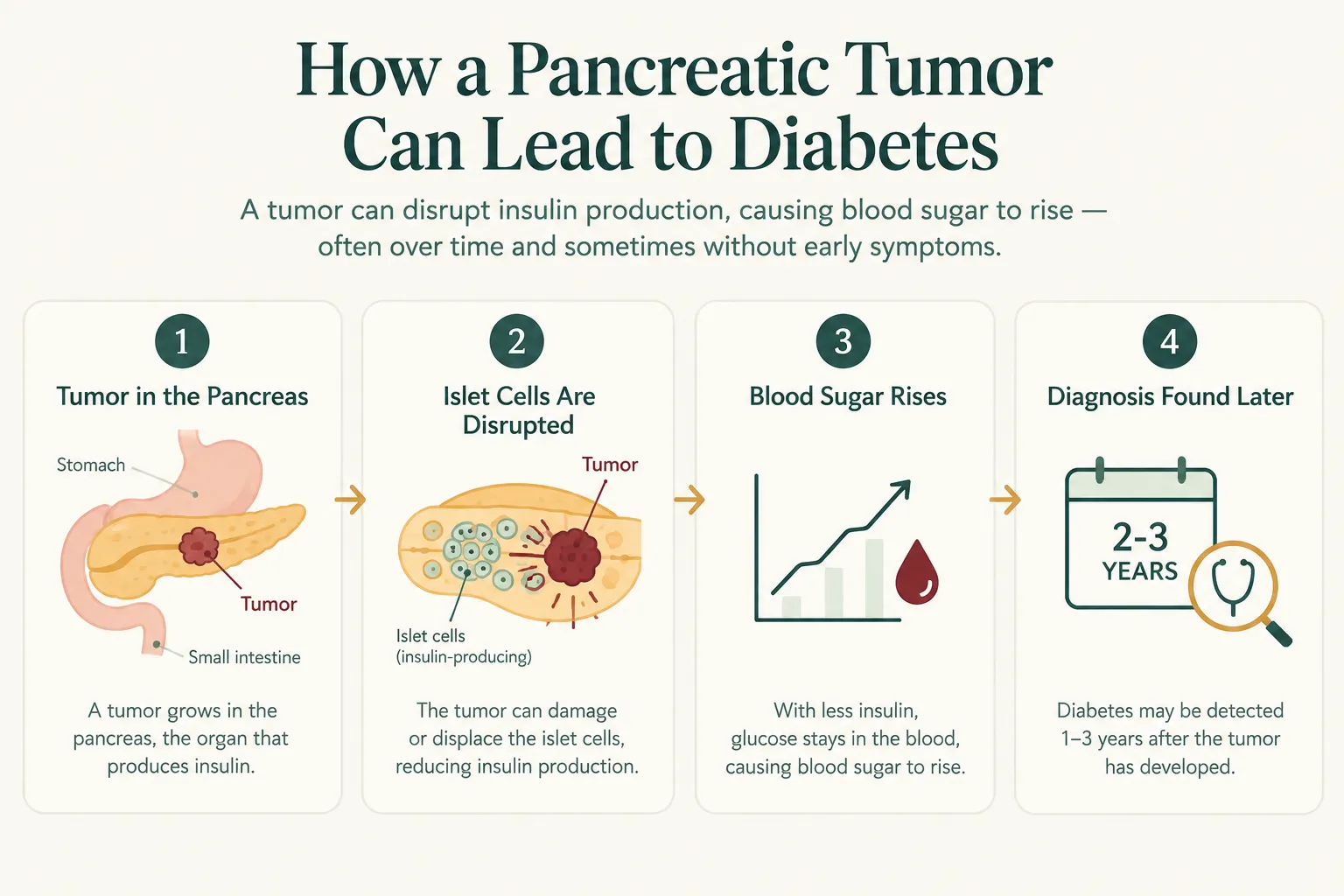 Infographic showing four steps: tumor in the pancreas, disrupted insulin-producing islet cells, rising blood sugar, and later diabetes diagnosis (2–3 years).