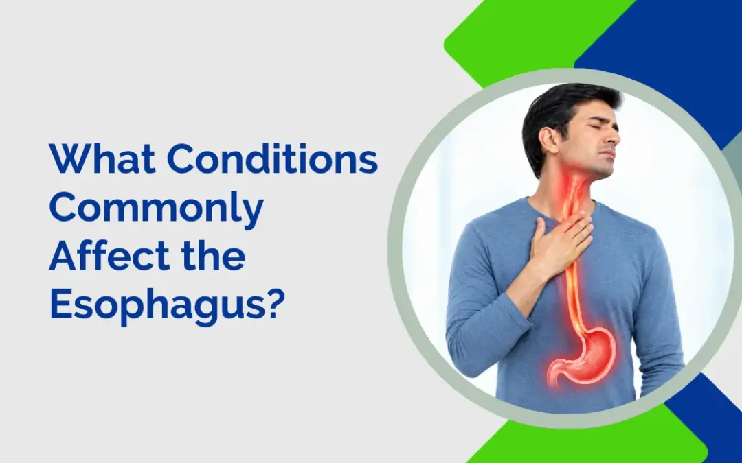 What Conditions Commonly Affect the Esophagus?