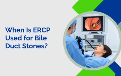 When Is ERCP Used for Bile Duct Stones?